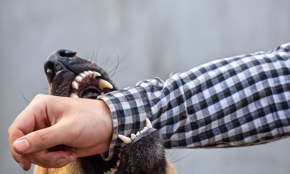 person getting bit by a dog in Houston, TX